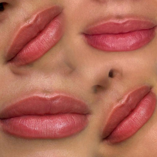  <span class="lte-header lte-h4"> Dermopigmentare buze </span> 